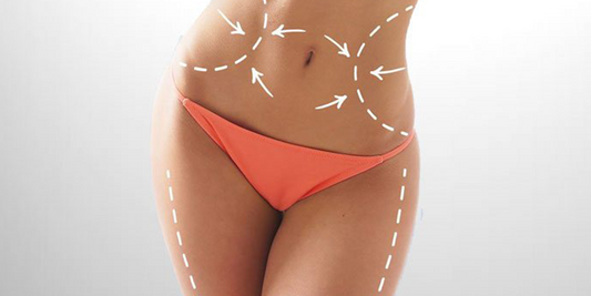 Liposuction 5 Zone